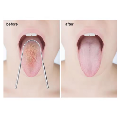 Tongue Cleaner